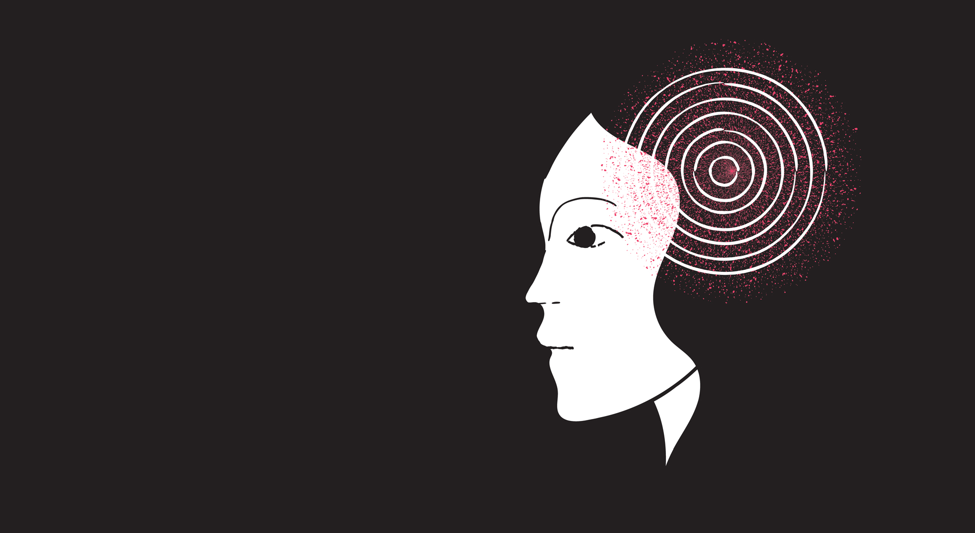 The 5 Types of Concussions